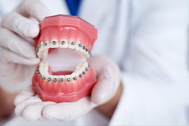 orthodontic.jpg