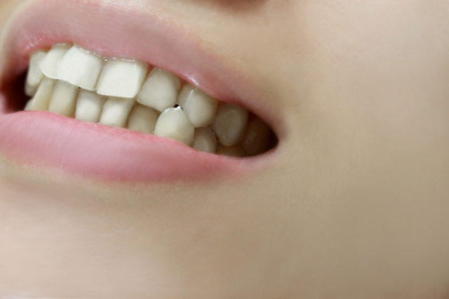 alignment-of-teeth.jpg
