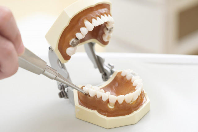Tooth-treatment-model.jpg